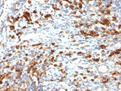 CD79A Antibody (IGA/764), Novus Biologicals 0.2mg; Unlabeled:Antibodies,